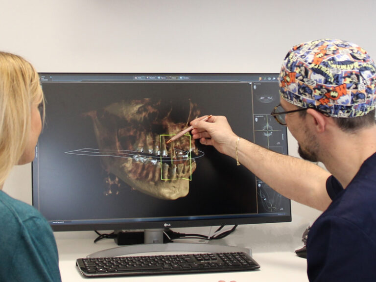 Dettaglio del braccio della TC Cone Beam Sirona